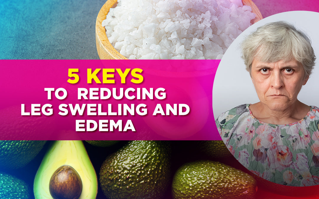 "5 Keys to Reducing Leg Swelling and Edema" text over avocados, sea salt, and an elderly woman.