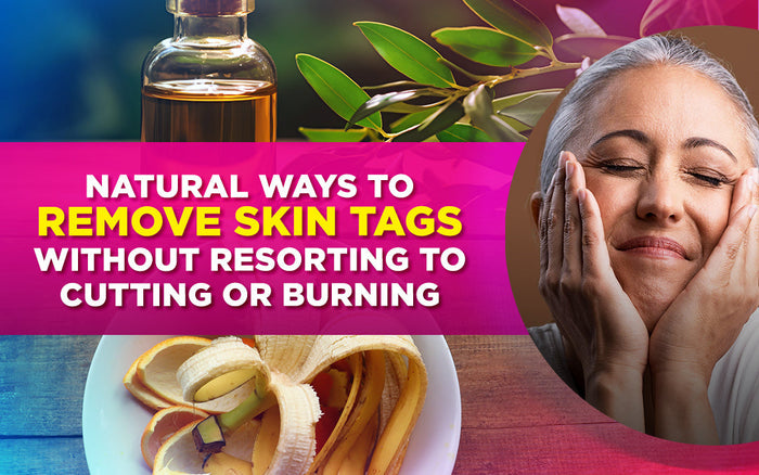 Natural ways to remove skin tags without cutting or burning, featuring banana peel and oil.