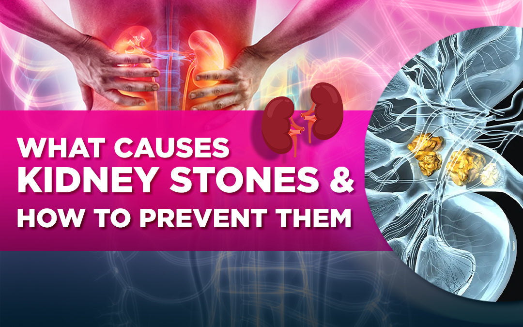 Kidney stones causes and prevention, with human kidneys, pain illustration, and stone formation.